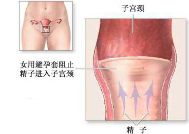 史上最出人意料的 十大怪异避孕法 