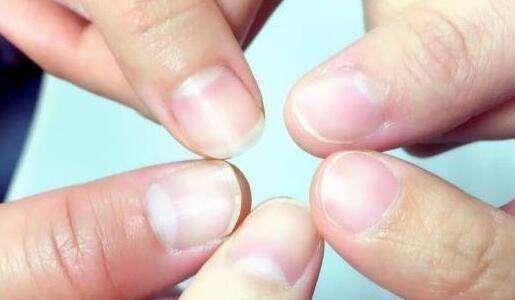 指甲上的月牙代表什么 指甲的月牙能够看出健康