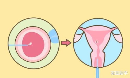 试管胚胎移植后用什么测试方法验孕最准？