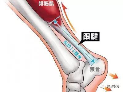 跑步得了跟腱炎 这样治疗最有效