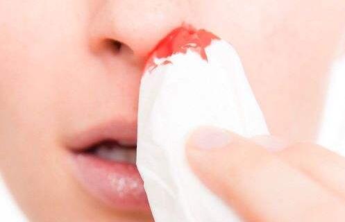 鼻出血很常见,但是如果反复鼻出血,可能是......