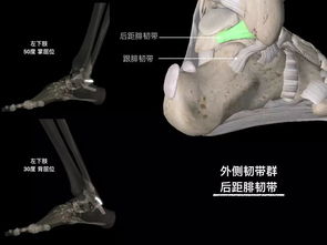 脚踝韧带图解 搜狗图片搜索