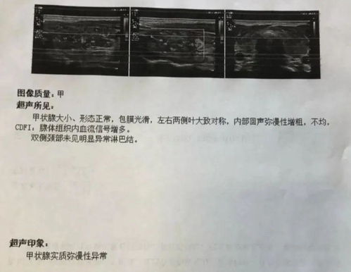 请问做甲状腺彩超检查的价格是多少呢(做甲状腺彩超大概多少钱)