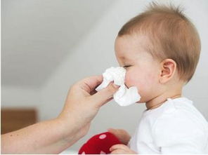 宝宝不感冒 老有鼻涕是怎么回事