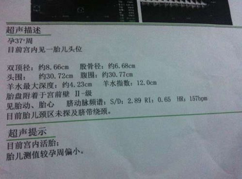 孕检时 B超单 上有5个字,可能小王子已在腹中,准确率极高