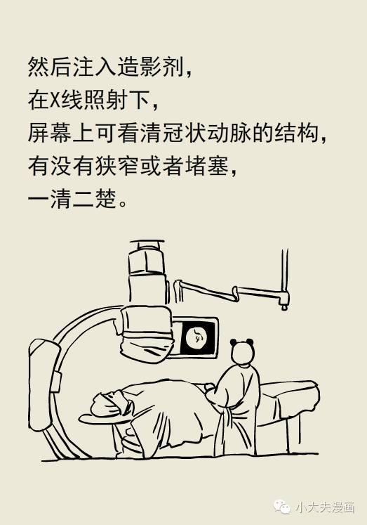 图解 冠脉造影