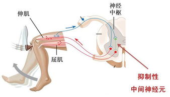 膝跳反应的介绍 