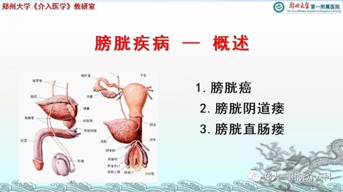 泌尿系疾病的介入治疗