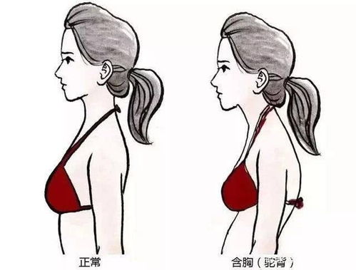 7个动作改善含胸驼背,秒变国际范