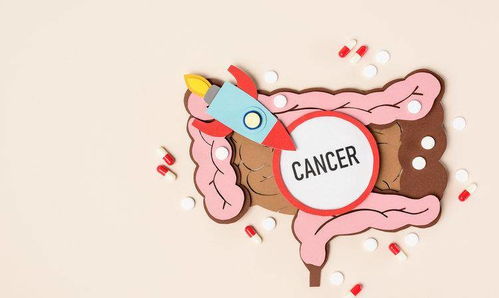 为什么得癌症的偏偏是你 研究发现 有些人得癌,是因为运气不好