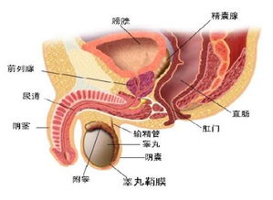 四年前因膀胱尿潴留做了膀胱造瘘术,最近 