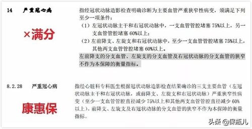 购买商业保险被投保人非亲自签名,理赔会有影响吗(被保险人签名不是本人亲自签名)