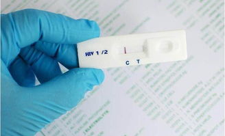 使用hiv试纸自测需要注意什么,有什么误区