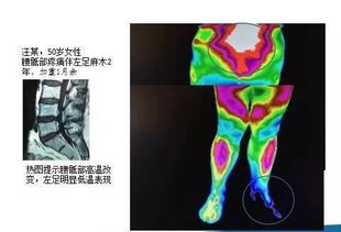 全身TMT热成像检查多少钱？