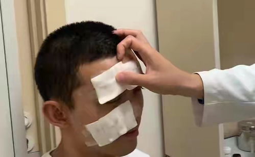 吴磊拍戏意外炸伤脸 伤口布满全脸 坚持拍完戏后才去医院就医