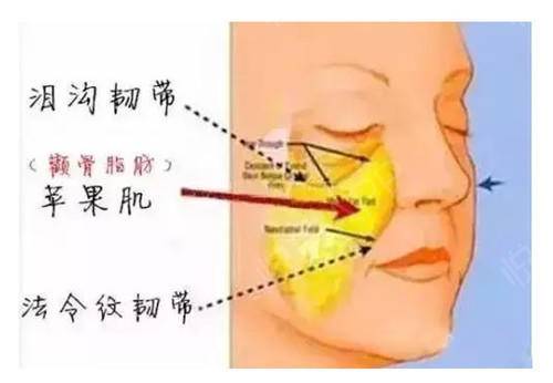 苹果肌可以换来苹果手机 呵呵