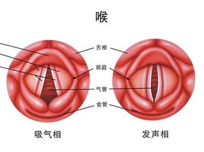 咽喉炎最佳治疗中成药见效快