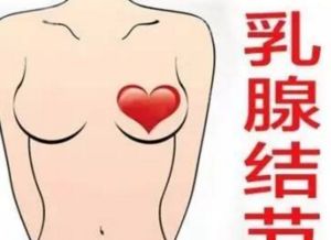 早期乳腺结节怎么用药