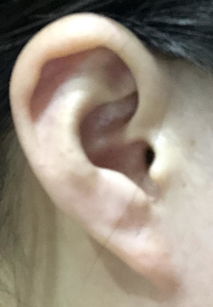 这是什么形状的耳朵 