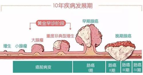 躁郁症的表现症状（躁郁症的表现症状测试30题）