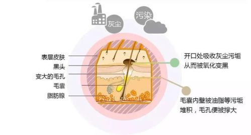 祛黑头大战 手把手教你祛 草莓鼻