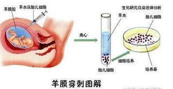 你对唐氏筛查了解多少 高风险 临界风险准确吗 