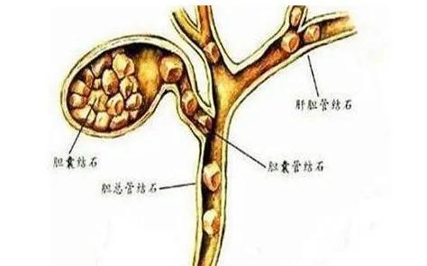 冷知识 晚上吃了夜宵,第二天早晨为什么比不吃还饿