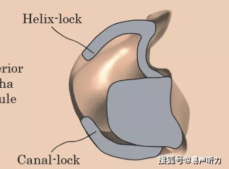 助听器小故障快速识别和解决方法