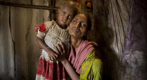 记录印度儿童生存状况 