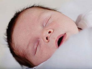 新生儿黄疸什么时间出现最好,新生儿多久出现黄疸？
