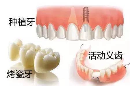 缺了一颗牙,不管它行不行