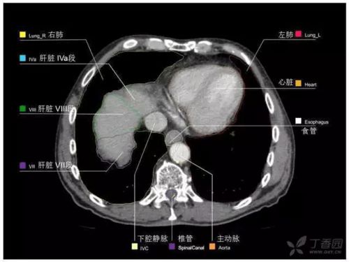 掌握这篇解剖,晋级腹部CT影像诊断高手 精细版
