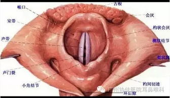 声带息肉的症状,声带息肉手术