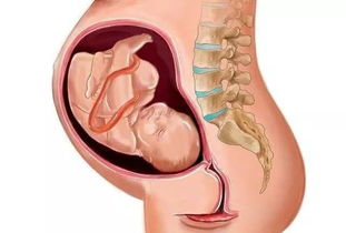 原创预产期前一周，孕妈有这3种“感觉”时，恭喜你，胎儿快入盆了！