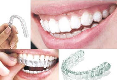 牙齿内侧有黄垢刮不掉 牙结石不清理掉会有哪些影响？ 