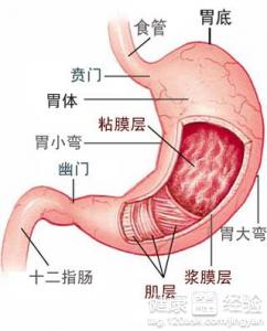 慢性胃炎 胃下垂反复发作怎么办呢