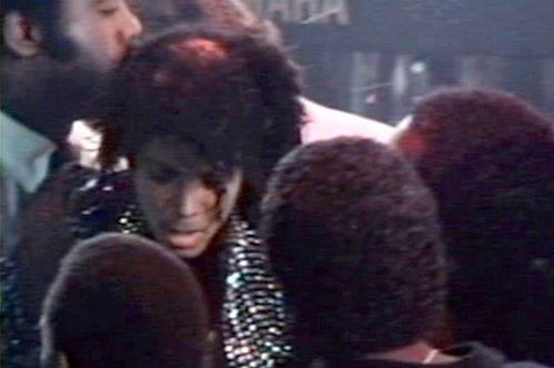 巨星迈克尔 杰克逊最新的尸检报告显示,他去世时已经几乎不成人 