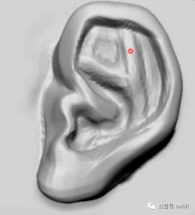 耳部结构图（耳朵门口肿了一按就疼）