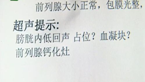 未确诊先治疗,男子花15000元后被查出患癌,院长 没怀疑是肿瘤