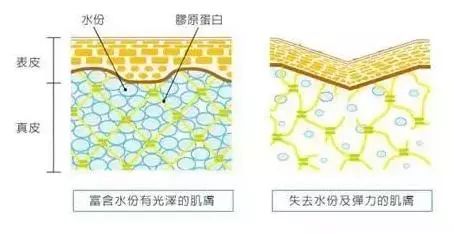 皮肤专家 从皮肤干燥原理浅谈面膜补水