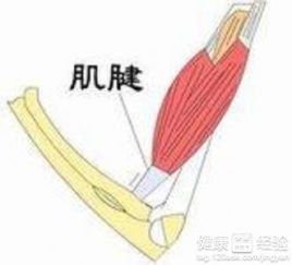 肌腱断裂术后1个半月拆石膏还要去医院吗