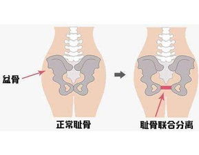 耻骨是哪个部位图片 搜狗图片搜索