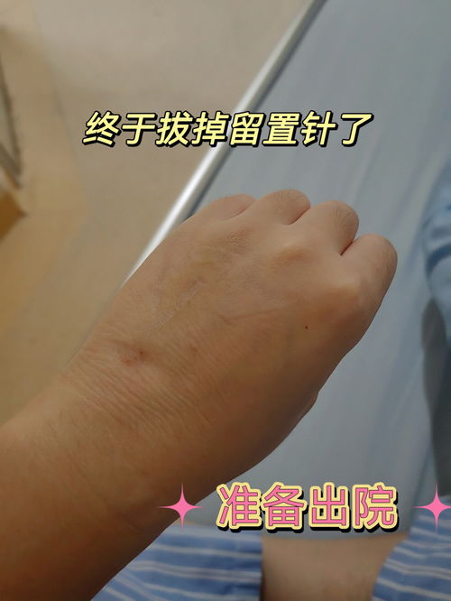 九月给我开了个玩笑 宫外孕 