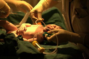 孕妇顺产过程(产妇顺产全过程)