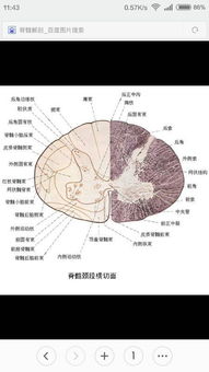 上运动神经元受损导致肢体硬瘫，下运动神经元受损导致肢体软瘫，那么一人左上肢软瘫，左下肢硬瘫为什么？