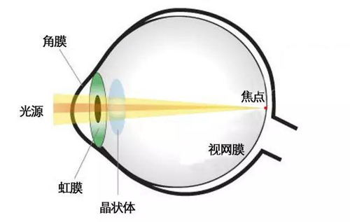 散光眼，散光眼有什么症状