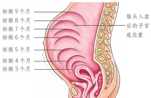 孕17周韧带变化可能让腹部有轻微触痛