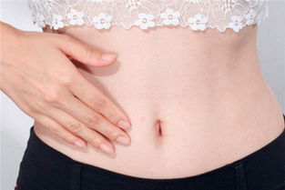 产后肚子上的妊娠纹怎么去除 产后肚子上的妊娠纹去除的方法-图2