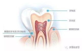 牙齿敏感发作 修复治疗才是硬道理 