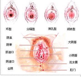 处女膜于非处女的对比图片谁有 